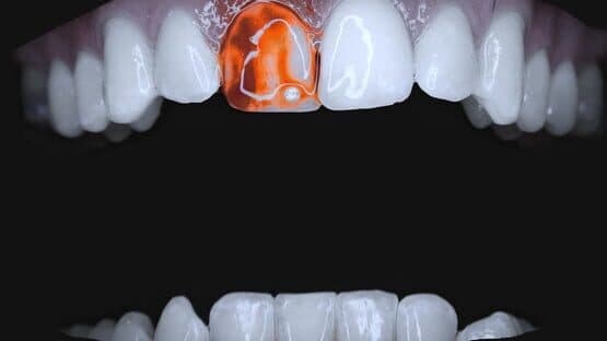 Teeth Cutter artwork 1